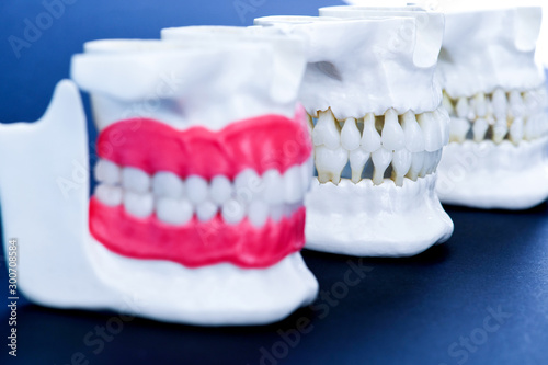 Human jaws with teeth and gums anatomy models