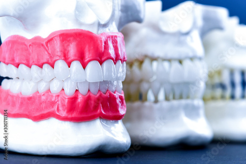 Wallpaper Mural Human jaws with teeth and gums anatomy models Torontodigital.ca