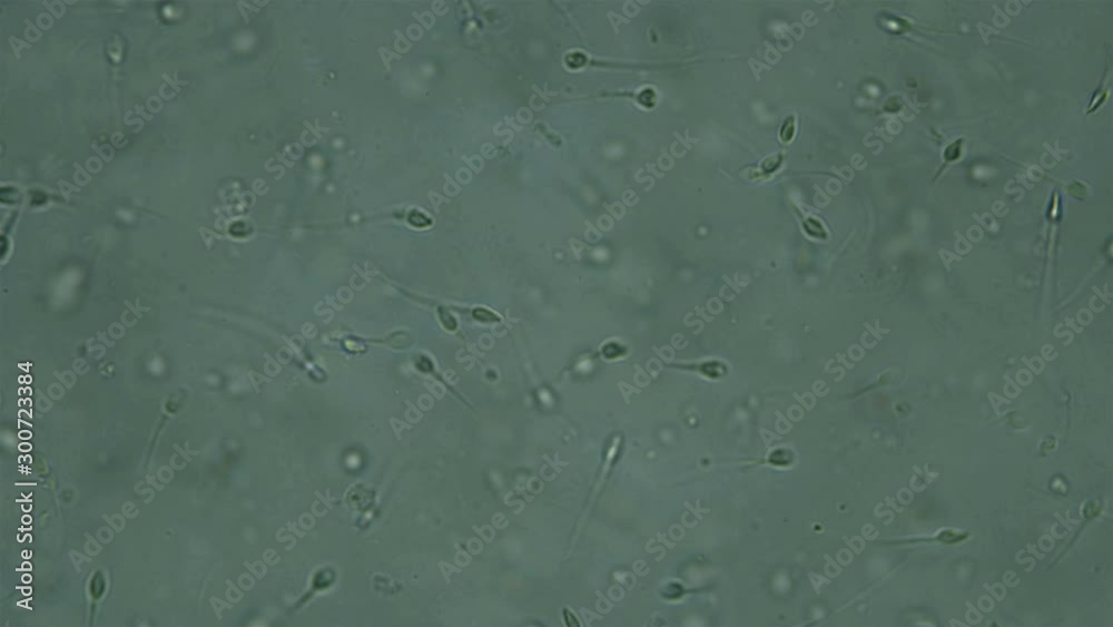 Sperm under the microscope, the movement of sperm cells in the seminal fluid, spermatozoa are the gamete male reproductive cell, have the ability to actively move and serve to fertilize the female egg Sperm under the microscope, the movement of sperm cells in the seminal fluid, spermatozoa are the gamete male reproductive cell, have the ability to actively move and serve to fertilize the female egg