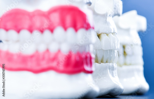 Wallpaper Mural Human jaws with teeth and gums anatomy models Torontodigital.ca