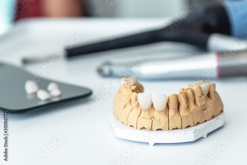 manufacture of veneers, dental implants and crowns in the dental laboratory.