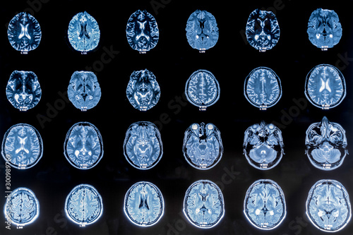 Series of CAT Scans showing the human head. Examination, treatment. Tamography, MRI, X-ray
