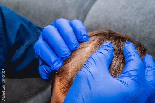 Checking the child's hair. Health and pharmaceutical concept, child health problems. The doctor checks the child's hair, head lice, possible lice infection.