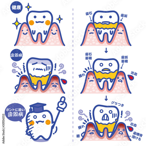 セイカツpickup/歯周病（青罫）