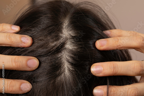Woman showing hair parting close up