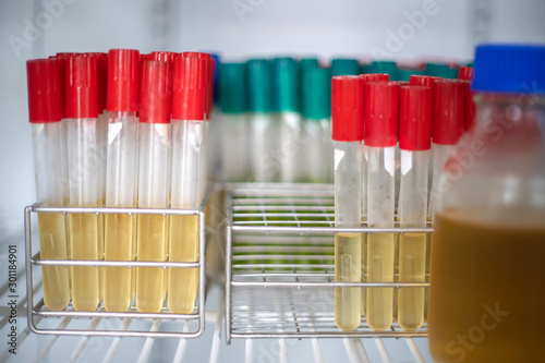 Fotografía Test tube for bacterial culture in cool incubator laboratory.