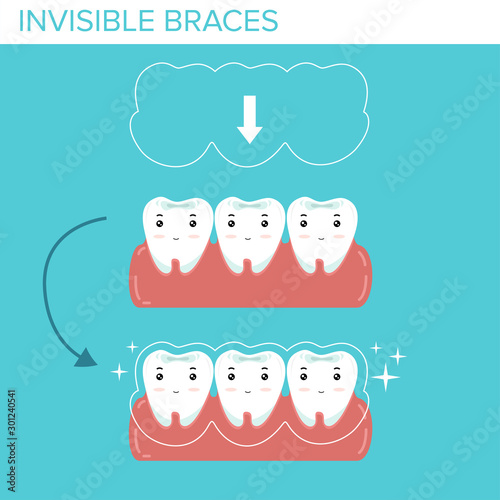 tooth with invisible braces on the blue background