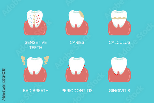 Cartoon Formation Dental Problems Set Health Care Tooth Concept Flat Design Style. Vector illustration