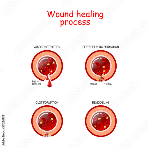 Phases of the wound healing process. poster with capillary, red blood cells, fibrin protein and platelets that healing wound.