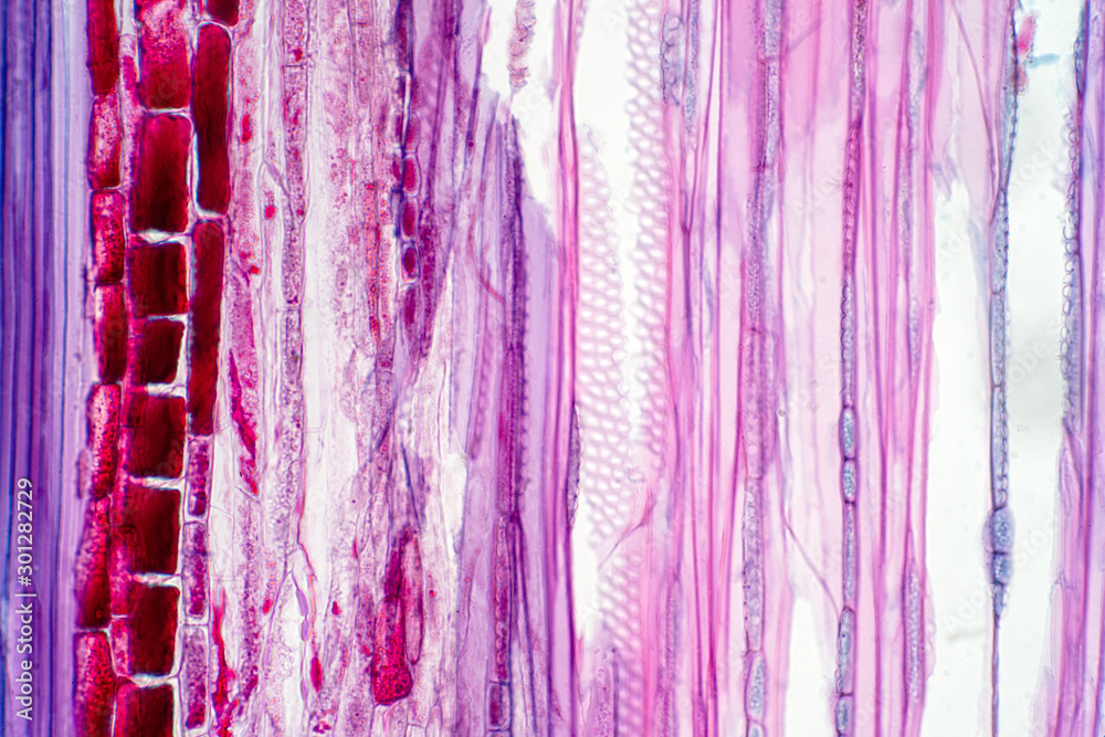 Plant vascular tissue under the microscope view.