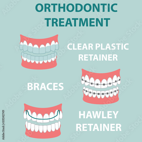 .vector illustration . orthodontic treatment