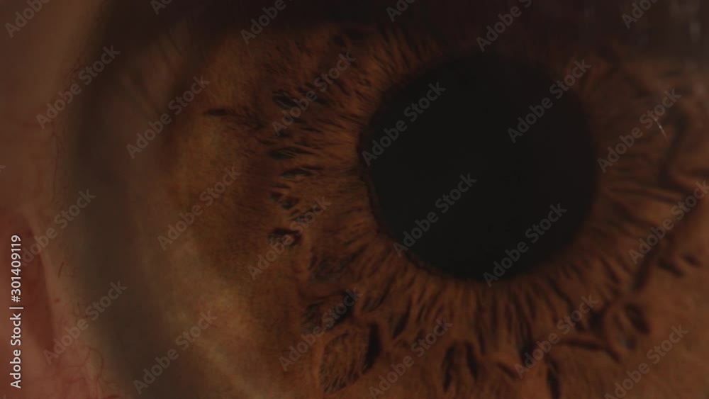Eye vessel