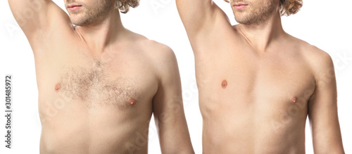 Young man before and after ...