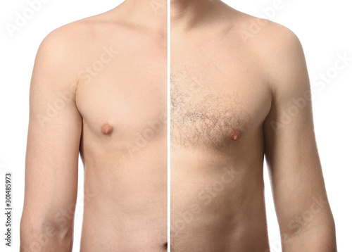 Young man before and after depilation on white background