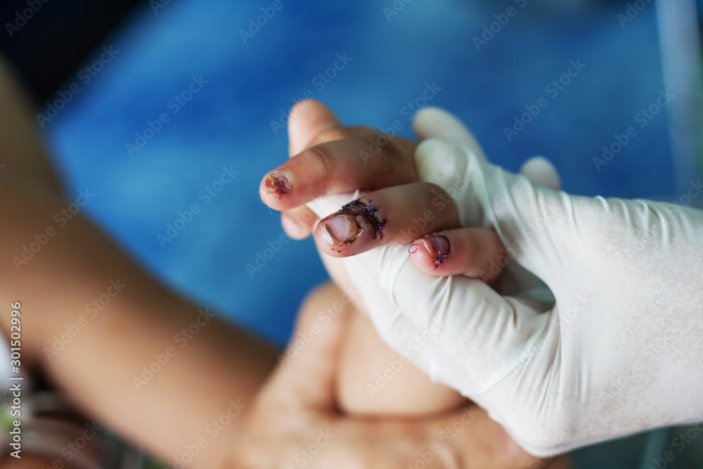 Fototapeta premium cutting finger wound