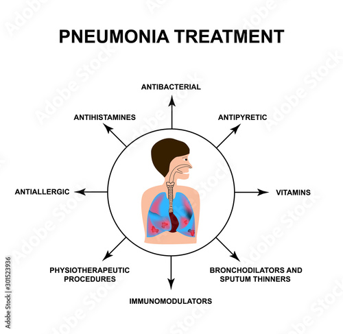The treatment of pneumonia. Human respiratory organs. World Pneumonia Day. The anatomical structure of inflamed lungs. Infographics. Vector illustration on isolated background.