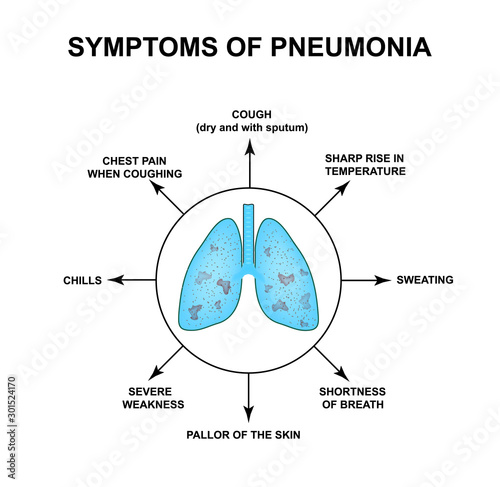 Symptoms of pneumonia. World Pneumonia Day. The anatomical structure of the lungs. Infographics. Vector illustration on isolated background.