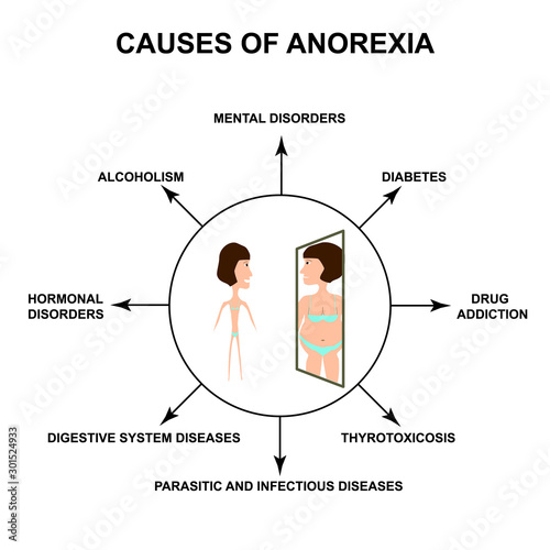 Causes of anorexia. Slim physique with anorexia. Reflection of obesity in the mirror. Infographics. Vector illustration on isolated background.