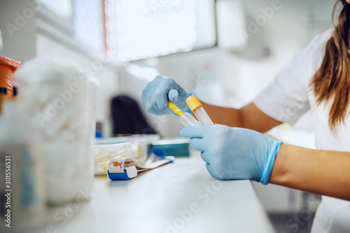 Foto Close up of female laboratory assistant preparing needle and test tubes for blood sampling