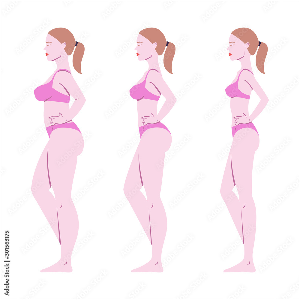 A woman body in underwear side view vector illustration.Different body mass.Stages of weight lose.Female cartoon characters.