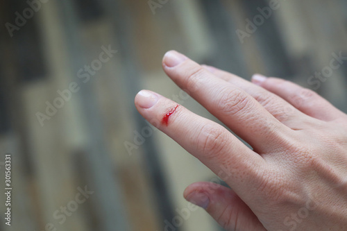 Finger with blood drop. Injured by sharp knife.
