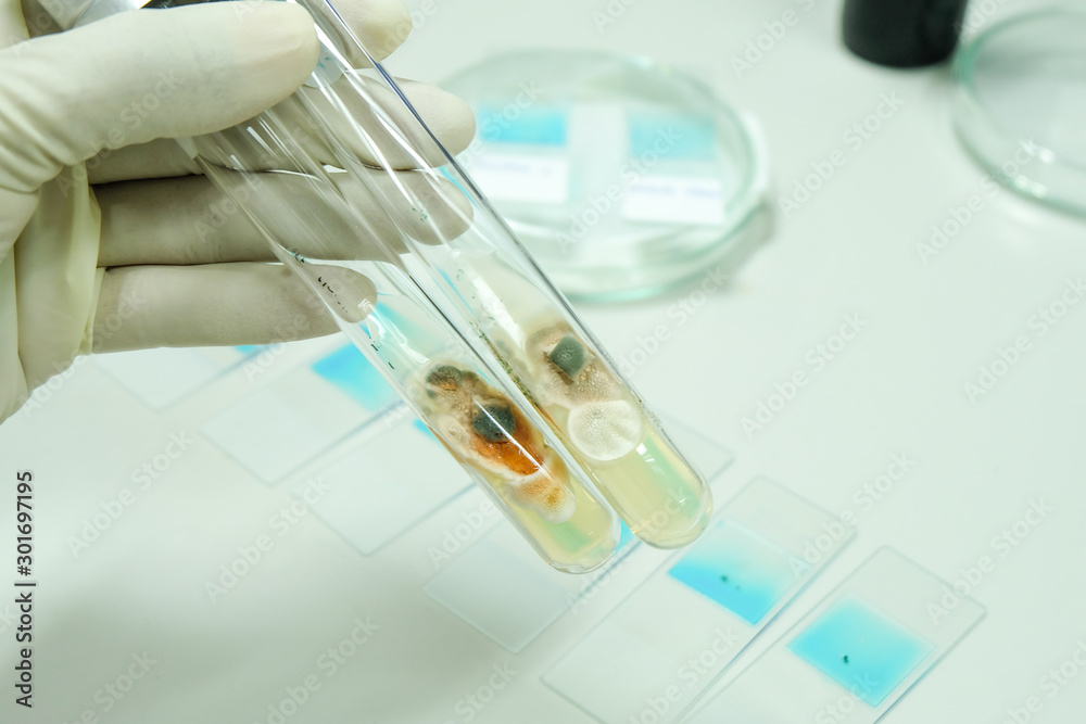 colony of fungi in test tube with microbiology concept colony of fungi in test tube with microbiology concept