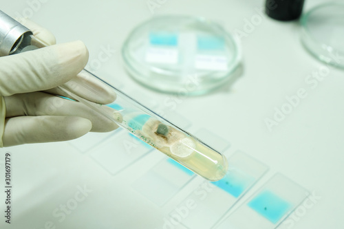 colony of fungi in test tube with microbiology concept