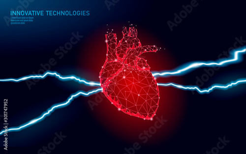 3D medicine heart attack warning. Human health diagnostics vascular organ system painful disease. Cardiology heart protect concept. Low poly vector illustration.