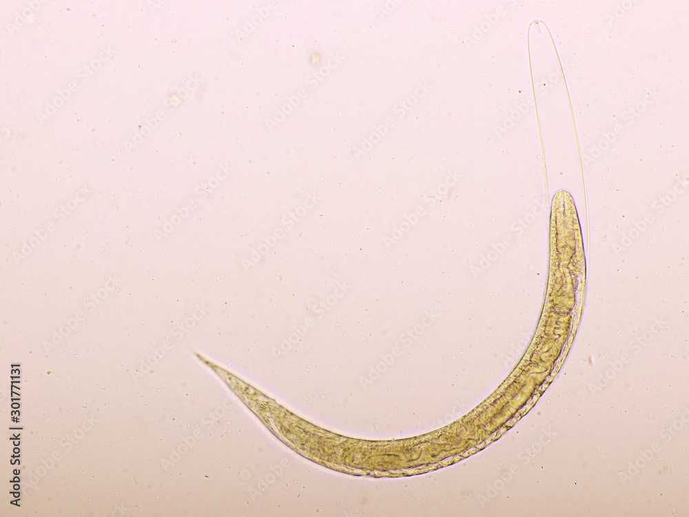 Foto de Strongyloides stercoralis or threadworm in human stool, analyze ...