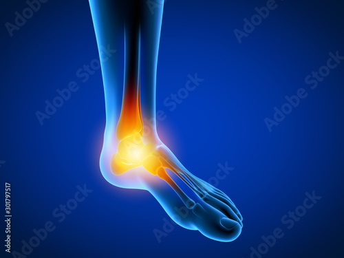 3d rendered medically accurate illustration of a man having a painful foot