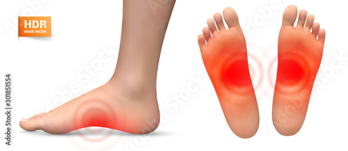 vector human foot.red spots of pain. ready element for medicine and orthopedics