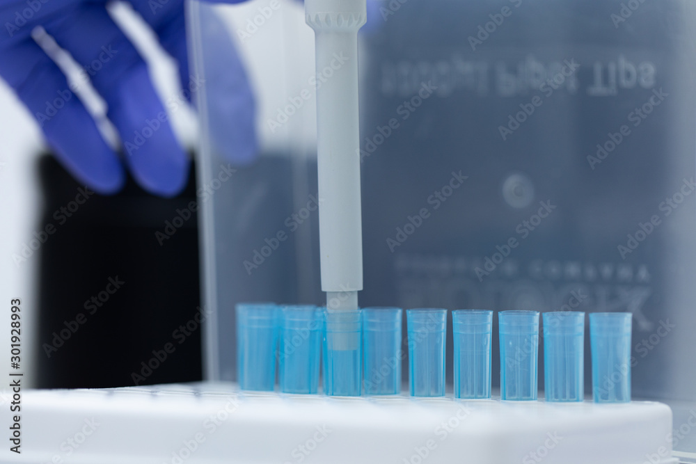 Polymerase Chain Reaction (PCR) and Agarose gel electrophoresis is a method of gel electrophoresis used in biochemistry, molecular biology, genetics, and clinical chemistry in lab.