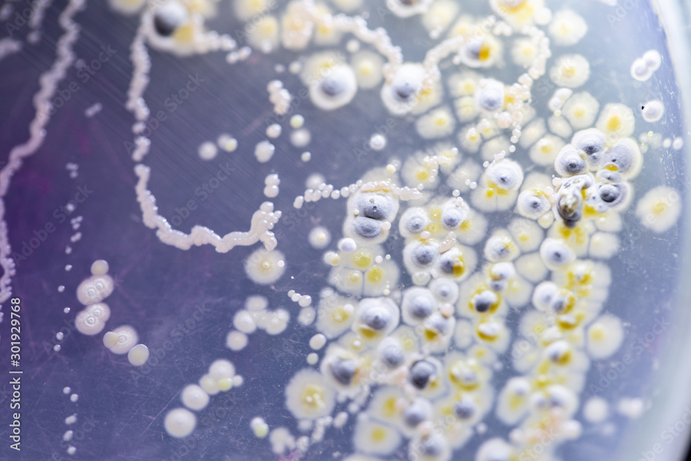 Mold Beautiful, Colony of Characteristics of Fungus (Mold) in culture medium plate from laboratory microbiology. Mold Beautiful, Colony of Characteristics of Fungus (Mold) in culture medium plate from laboratory microbiology.