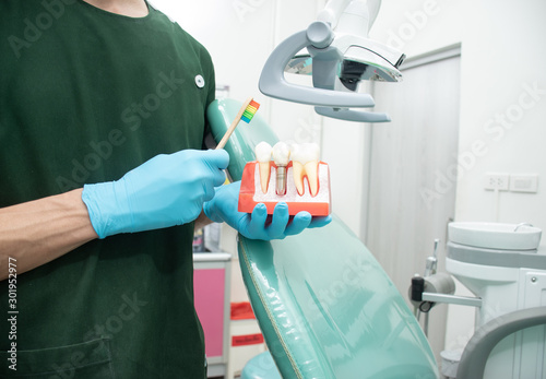 Male dentist carrying a sample of dental implants.