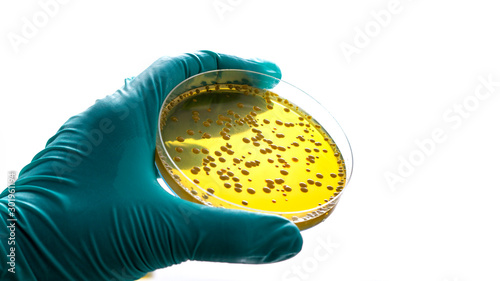 Gloved hand holding a Petri dish Bacteria culture