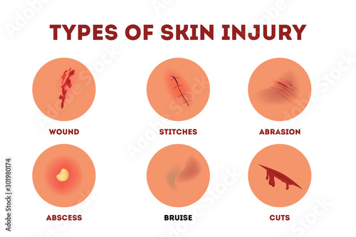 Set of vector illustration of physical body injury. Isolated cartoon style