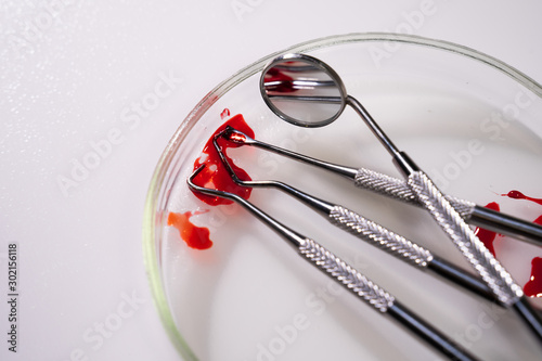 Fotografija Photo of tools in dental surgery