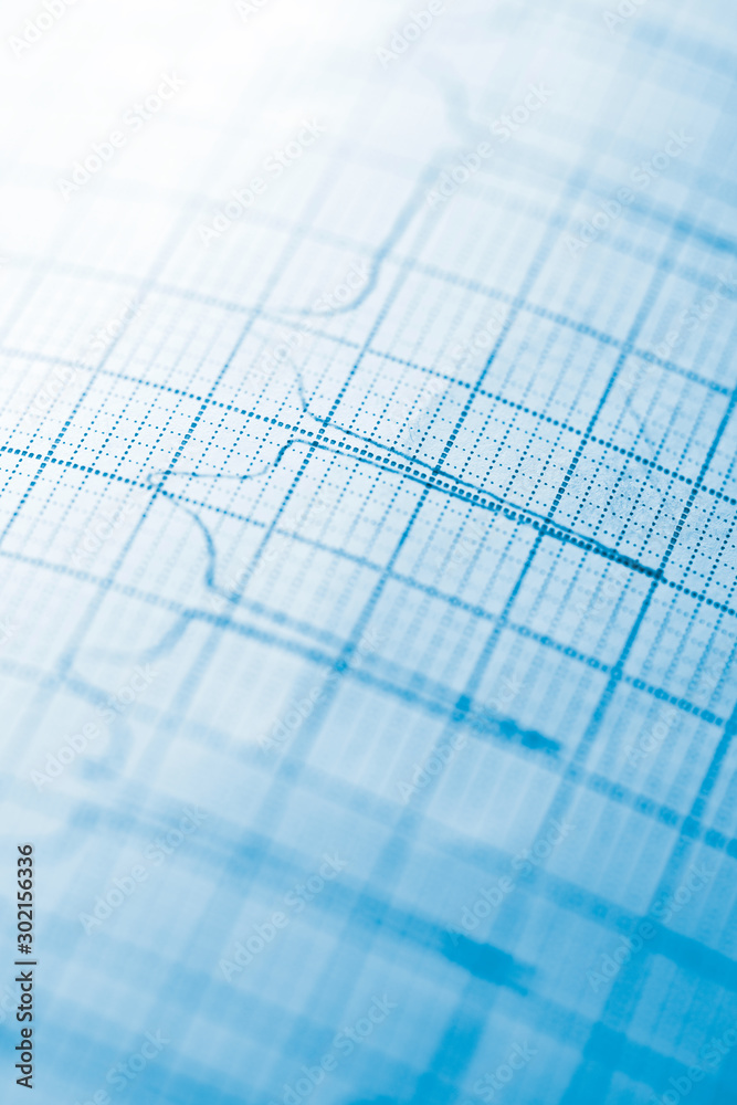 Electrocardiogram close up Electrocardiogram close up