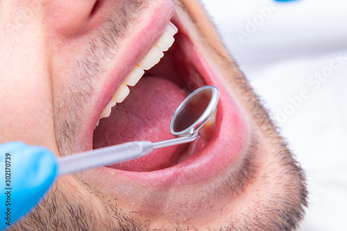 Cuadro en lienzo open mouth with dentist's mirror