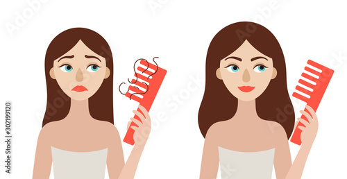 Young woman with hair loss problem before and after treatment. Alopecia. Flat vector isolated illustration on white background