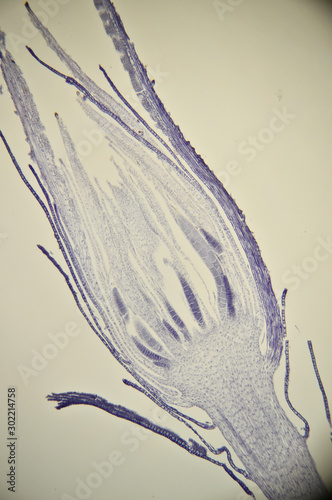 Anther moss under the microscope photo
