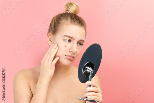 Upset girl looks in the mirror at her problem skin with red acne and post-acne isolated on a pink background photo