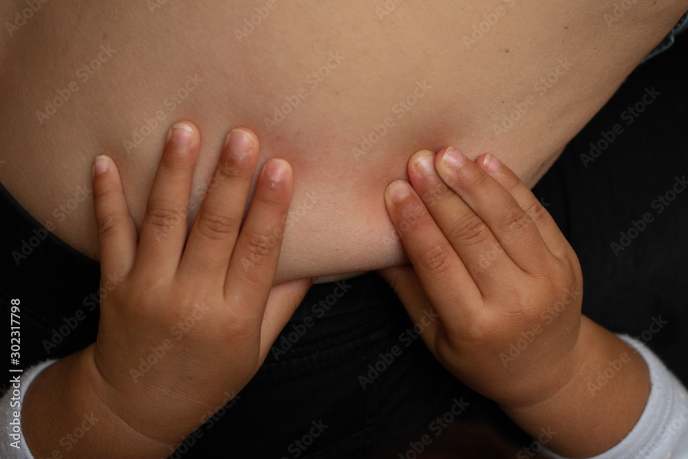 Kid touching skin on parent body, excess weight