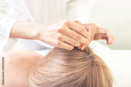 Woman on acupuncture