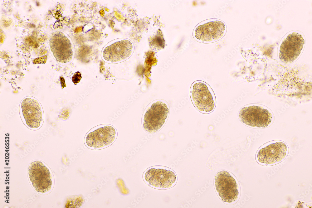 Human Hookworm Egg