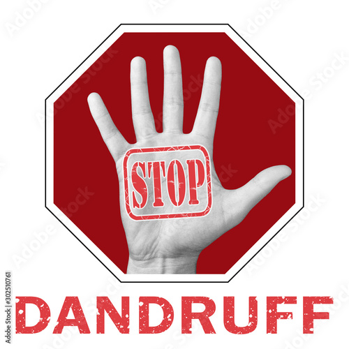 Stop dandruff conceptual illustration. Open hand with the text stop dandruff.