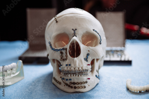 Plastic model of the skull for stomatology and maxillofacial surgery.