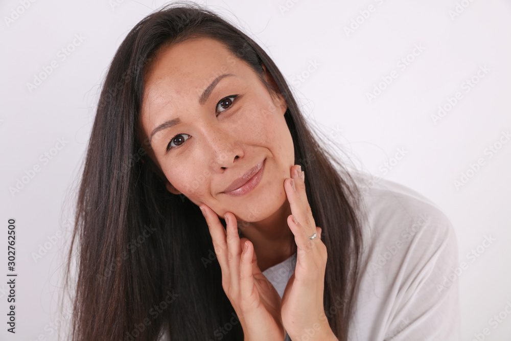 Female Skin Problems : pimple scars and acne Female Skin Problems : pimple scars and acne