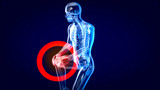 Knee sprain or ache leading to pain 3D illustration