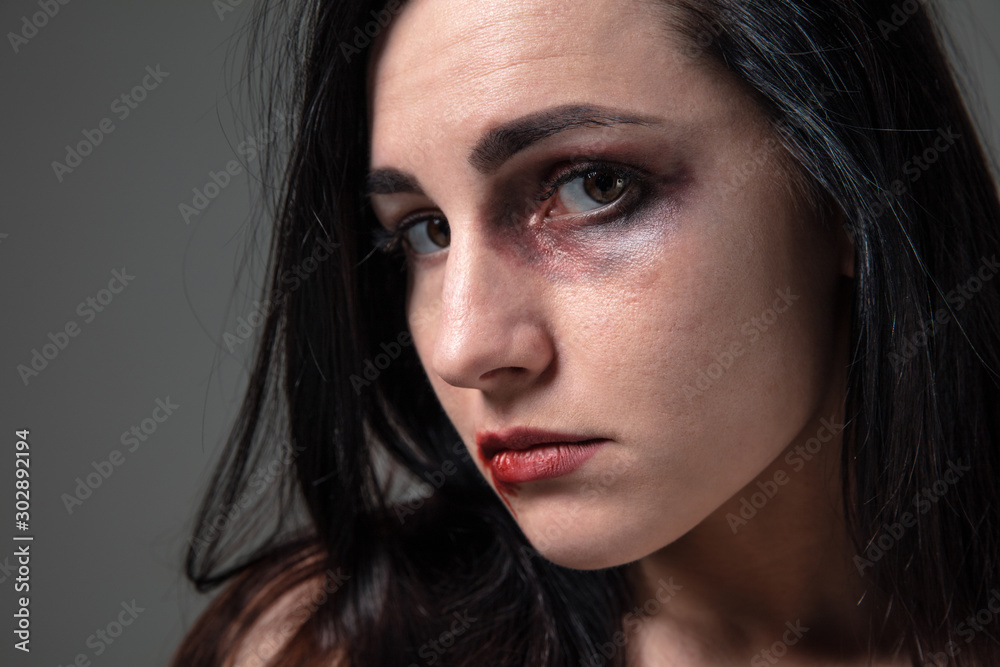 Fototapeta premium Woman in fear of domestic abuse and violence, concept of female rights. Caucasian brunette woman on grey background looks upset, sad, depressed being victim of man or husband. Has bruises, hematomas.